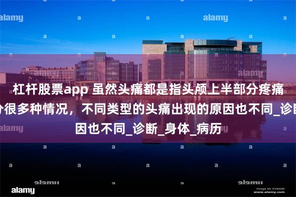 杠杆股票app 虽然头痛都是指头颅上半部分疼痛，但头痛也分很多种情况，不同类型的头痛出现的原因也不同_诊断_身体_病历